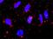 MAPK Activated Protein Kinase 3 antibody, H00007867-M02, Novus Biologicals, Proximity Ligation Assay image 