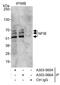 Nuclear Factor I B antibody, A303-566A, Bethyl Labs, Immunoprecipitation image 