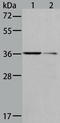 Aldo-Keto Reductase Family 1 Member B10 antibody, TA321873, Origene, Western Blot image 