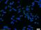 Suppressor Of Cytokine Signaling 5 antibody, 12783-1-AP, Proteintech Group, Immunofluorescence image 