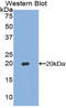 CDKN2A antibody, LS-C293600, Lifespan Biosciences, Western Blot image 