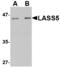 Ceramide Synthase 5 antibody, A08612-1, Boster Biological Technology, Western Blot image 