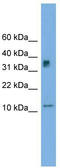 Chromosome 15 Open Reading Frame 40 antibody, TA340333, Origene, Western Blot image 