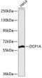 Decapping MRNA 1A antibody, 14-987, ProSci, Western Blot image 