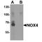 NADPH Oxidase 4 antibody, TA349083, Origene, Western Blot image 