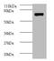 Arginine Vasopressin Receptor 1A antibody, A53272-100, Epigentek, Western Blot image 