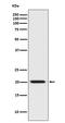 BCL2 Associated Agonist Of Cell Death antibody, M03520, Boster Biological Technology, Western Blot image 