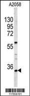 Homeobox A9 antibody, 63-789, ProSci, Western Blot image 