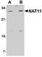 N(Alpha)-Acetyltransferase 40, NatD Catalytic Subunit antibody, A13562, Boster Biological Technology, Western Blot image 