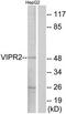 Vasoactive Intestinal Peptide Receptor 2 antibody, TA312101, Origene, Western Blot image 