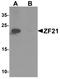 Zinc finger FYVE domain-containing protein 21 antibody, TA326630, Origene, Western Blot image 