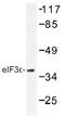 Eukaryotic translation initiation factor 3 subunit E antibody, AP01470PU-N, Origene, Western Blot image 
