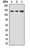 Electrogenic sodium bicarbonate cotransporter 4 antibody, LS-C667777, Lifespan Biosciences, Western Blot image 