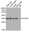 HLA class II histocompatibility antigen, DQ alpha 1 chain antibody, LS-C193085, Lifespan Biosciences, Western Blot image 