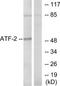 CREB2 antibody, TA316504, Origene, Western Blot image 