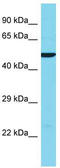 Keratin 38 antibody, TA332024, Origene, Western Blot image 