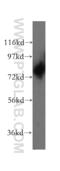 DEAD-Box Helicase 4 antibody, 51042-1-AP, Proteintech Group, Western Blot image 
