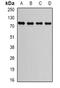 Golgi Associated, Gamma Adaptin Ear Containing, ARF Binding Protein 2 antibody, orb340740, Biorbyt, Western Blot image 