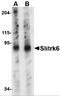 SLIT And NTRK Like Family Member 6 antibody, 4481, ProSci, Western Blot image 