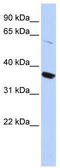 Potassium Voltage-Gated Channel Subfamily A Member 10 antibody, TA338555, Origene, Western Blot image 