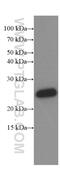 Potassium Voltage-Gated Channel Interacting Protein 1 antibody, 66439-1-Ig, Proteintech Group, Western Blot image 