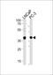 Vitamin D Receptor antibody, PA5-35156, Invitrogen Antibodies, Western Blot image 