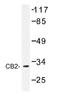 Cannabinoid Receptor 2 antibody, AP01212PU-N, Origene, Western Blot image 