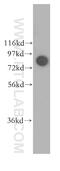 DEAD-Box Helicase 1 antibody, 11357-1-AP, Proteintech Group, Western Blot image 