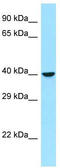 Ras Related GTP Binding B antibody, TA331223, Origene, Western Blot image 