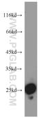 Signal Peptidase Complex Subunit 2 antibody, 14872-1-AP, Proteintech Group, Western Blot image 