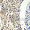 FACT antibody, A6413, ABclonal Technology, Immunohistochemistry paraffin image 