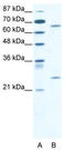 Forkhead box protein K2 antibody, TA330064, Origene, Western Blot image 