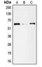 SMAD Family Member 1 antibody, LS-C352484, Lifespan Biosciences, Western Blot image 