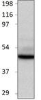Bone Morphogenetic Protein 2 antibody, GTX14933, GeneTex, Western Blot image 