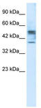 Carbohydrate Sulfotransferase 4 antibody, TA339119, Origene, Western Blot image 