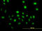Vav Guanine Nucleotide Exchange Factor 1 antibody, LS-C198421, Lifespan Biosciences, Immunofluorescence image 