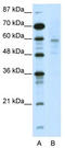 DNA Methyltransferase 1 Associated Protein 1 antibody, TA345265, Origene, Western Blot image 