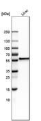 Fibrinogen Beta Chain antibody, HPA001900, Atlas Antibodies, Western Blot image 