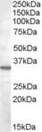 B1 bradykinin receptor antibody, NB100-96919, Novus Biologicals, Western Blot image 
