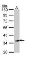 Bone Marrow Stromal Cell Antigen 1 antibody, GTX112703, GeneTex, Western Blot image 