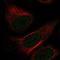 NUDT7 antibody, NBP1-91125, Novus Biologicals, Immunofluorescence image 