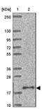 Adaptor Related Protein Complex 1 Subunit Sigma 1 antibody, NBP2-46862, Novus Biologicals, Western Blot image 