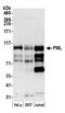Promyelocytic Leukemia antibody, A301-167A, Bethyl Labs, Western Blot image 