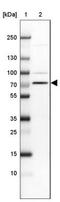 Solute Carrier Family 44 Member 3 antibody, NBP2-13339, Novus Biologicals, Western Blot image 