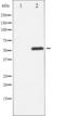 CREB2 antibody, TA325236, Origene, Western Blot image 