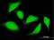 Zinc Finger NFX1-Type Containing 1 antibody, H00057169-B01P, Novus Biologicals, Immunocytochemistry image 