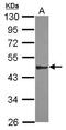 Spermatogenesis Associated 6 antibody, GTX119893, GeneTex, Western Blot image 