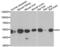 Indian Hedgehog Signaling Molecule antibody, LS-C334838, Lifespan Biosciences, Western Blot image 