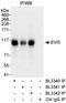 Ecotropic viral integration site 5 protein antibody, A300-874A, Bethyl Labs, Immunoprecipitation image 
