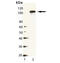 Heat shock protein 104 antibody, ADI-SPA-1040-F, Enzo Life Sciences, Western Blot image 